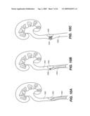 SELF-EXPANDING DEVICES AND METHODS THEREFOR diagram and image