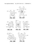 SELF-EXPANDING DEVICES AND METHODS THEREFOR diagram and image