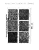 TREATMENT AND PREVENTION OF ABNORMAL CELLULAR PROLIFERATION diagram and image