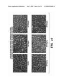 TREATMENT AND PREVENTION OF ABNORMAL CELLULAR PROLIFERATION diagram and image