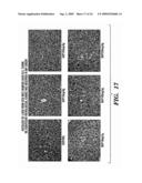 TREATMENT AND PREVENTION OF ABNORMAL CELLULAR PROLIFERATION diagram and image