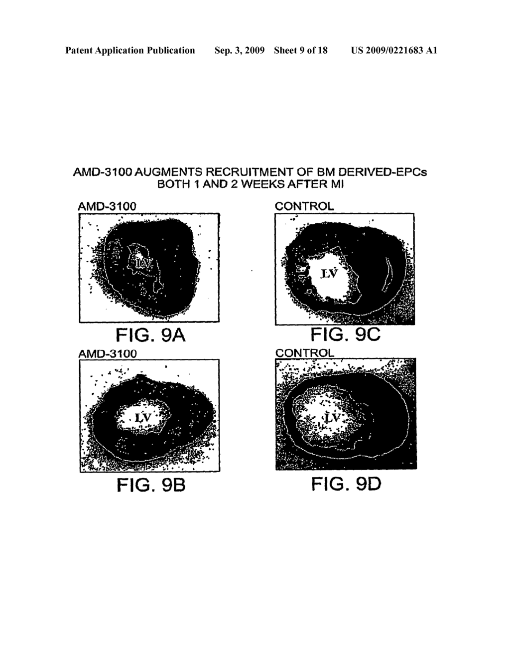 Combination of CXCR4 Antagonist and Morphogen to Increase Angiogenesis - diagram, schematic, and image 10