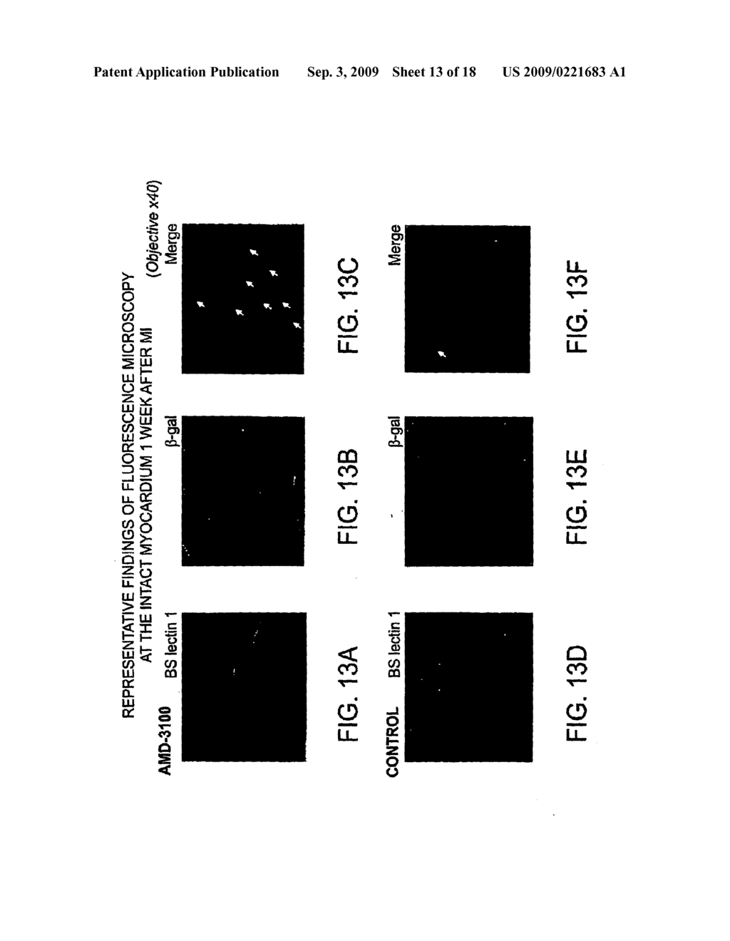 Combination of CXCR4 Antagonist and Morphogen to Increase Angiogenesis - diagram, schematic, and image 14