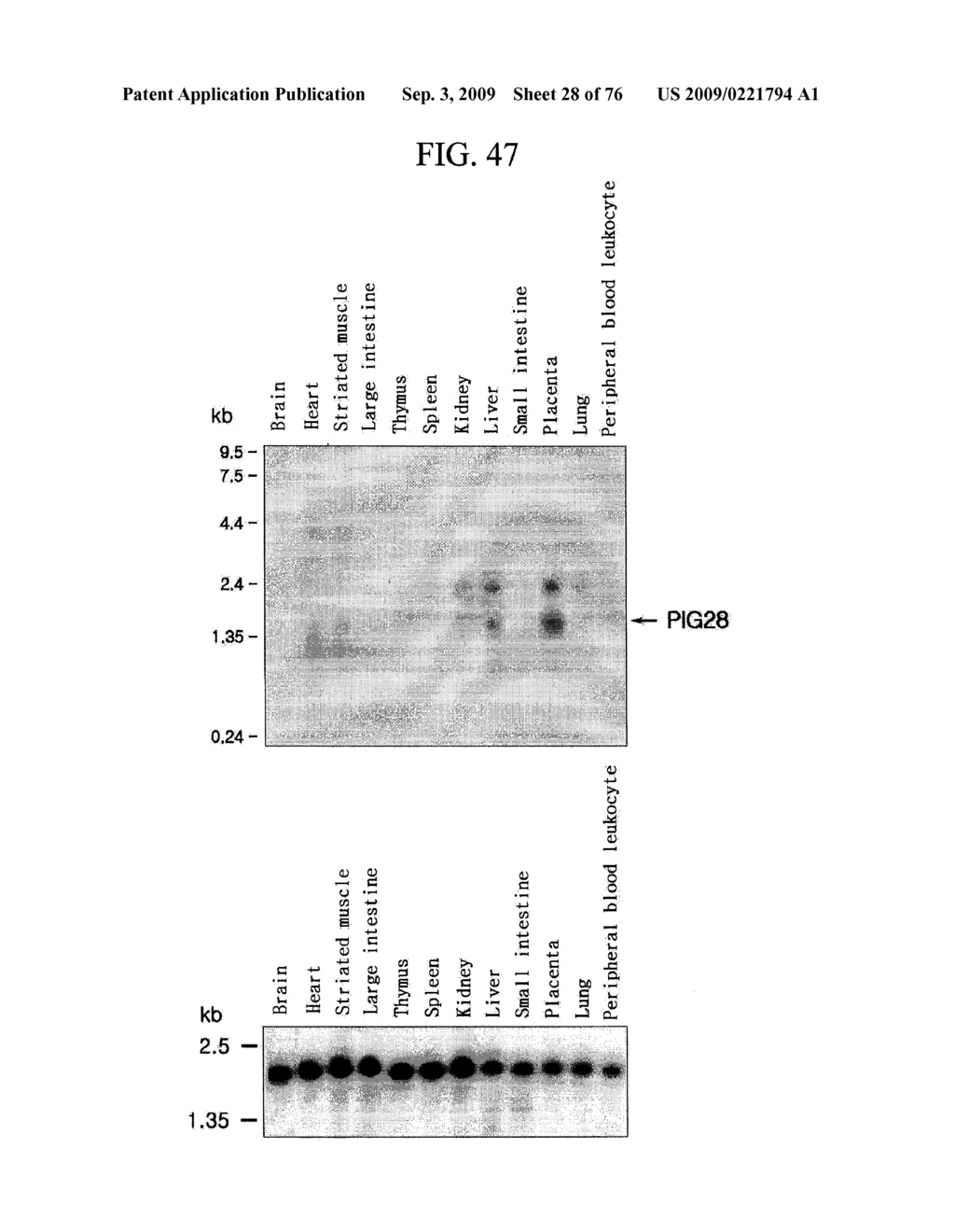 Human Protooncogene and Protein Encoded By Same - diagram, schematic, and image 29