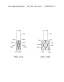 PRECISION CONTROL SYSTEMS FOR TISSUE VISUALIZATION AND MANIPULATION ASSEMBLIES diagram and image