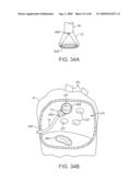 PRECISION CONTROL SYSTEMS FOR TISSUE VISUALIZATION AND MANIPULATION ASSEMBLIES diagram and image