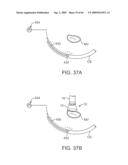 PRECISION CONTROL SYSTEMS FOR TISSUE VISUALIZATION AND MANIPULATION ASSEMBLIES diagram and image