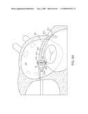 PRECISION CONTROL SYSTEMS FOR TISSUE VISUALIZATION AND MANIPULATION ASSEMBLIES diagram and image