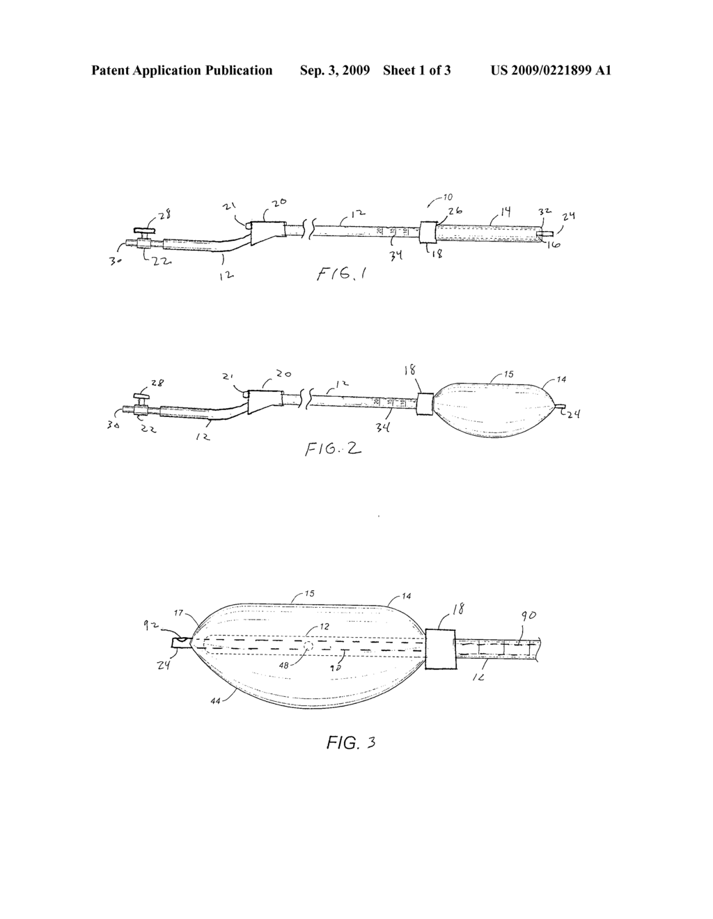 MINIMALLY INVASIVE RECTAL BALLOON APPARATUS WITH PRESSURE RELIEVING LUMEN AND ANAL VERGE DILATION COLLAR - diagram, schematic, and image 02