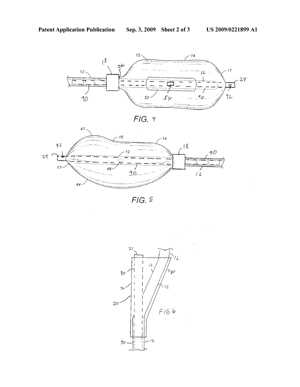 MINIMALLY INVASIVE RECTAL BALLOON APPARATUS WITH PRESSURE RELIEVING LUMEN AND ANAL VERGE DILATION COLLAR - diagram, schematic, and image 03