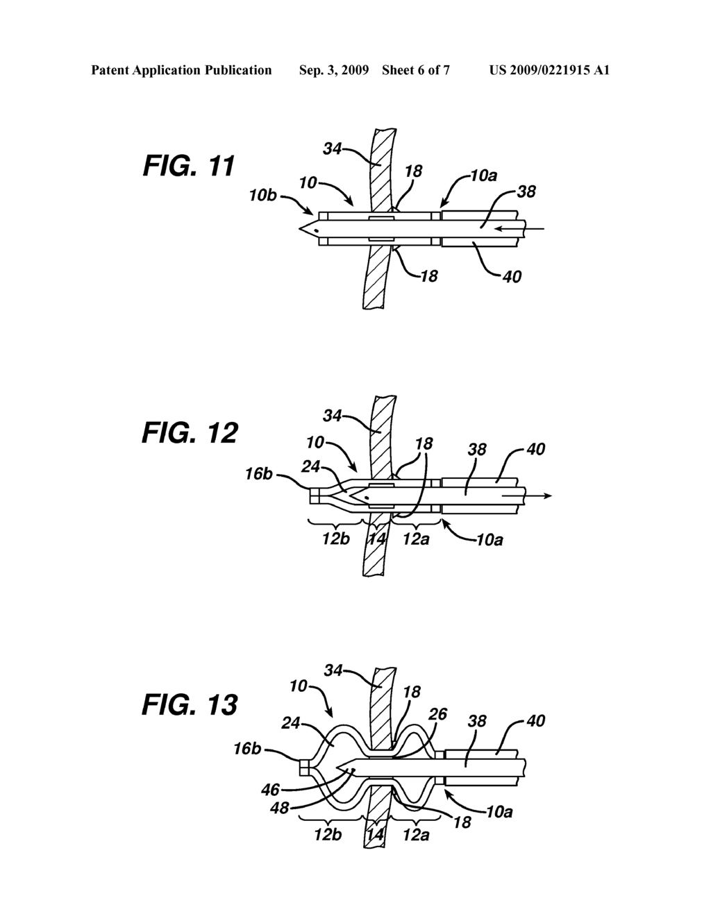 TRANSLUMINAL TISSUE MARKERS - diagram, schematic, and image 07