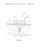 Method and Apparatus for Treatment of Adipose Tissue diagram and image