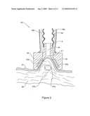 Method and Apparatus for Treatment of Adipose Tissue diagram and image