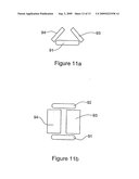 Method and Apparatus for Treatment of Adipose Tissue diagram and image