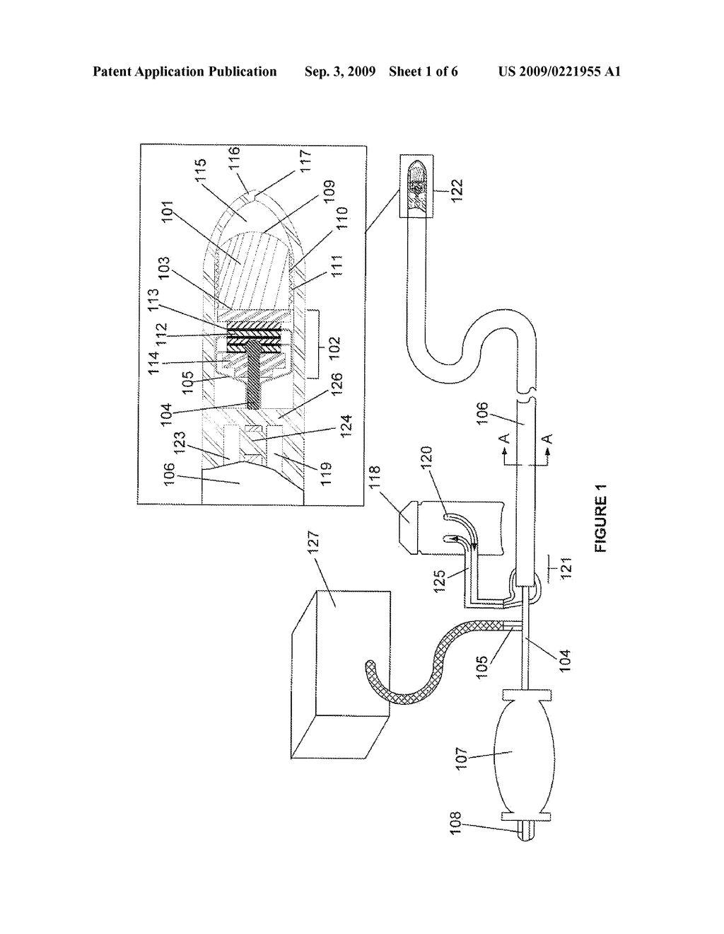 ABLATIVE ULTRASONIC-CRYOGENIC METHODS - diagram, schematic, and image 02