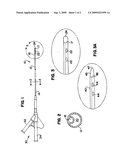 ELONGATED MEDICAL APPARATUS WITH INFLATABLE TIP diagram and image