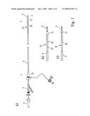 Intravascular Device diagram and image