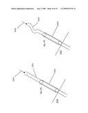 METHOD AND APPARATUS FOR SECURING A LINE TO A PATIENT diagram and image