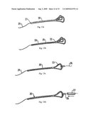 METHOD AND APPARATUS FOR SECURING A LINE TO A PATIENT diagram and image