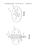 Fluid Drainage Catheter Having an External Flow Path diagram and image