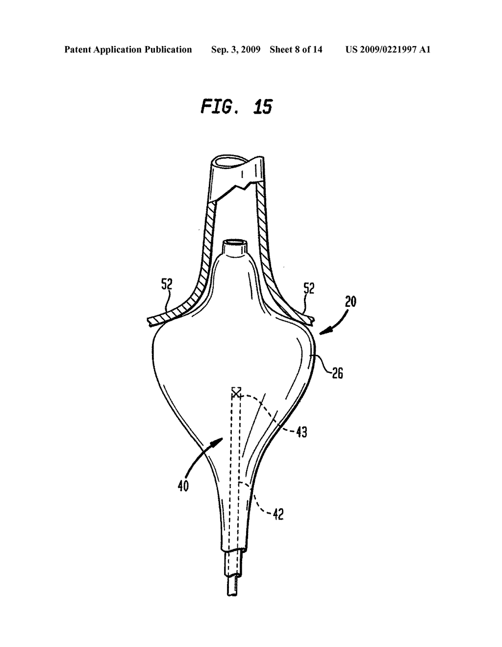 COAXIAL CATHETER INSTRUMENTS FOR ABLATION WITH RADIANT ENERGY - diagram, schematic, and image 09