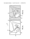 Thermal Ablation Design and Planning Methods diagram and image