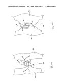 SURGICAL FASTENING CLIPS, SYSTEMS AND METHODS FOR PROXIMATING TISSUE diagram and image