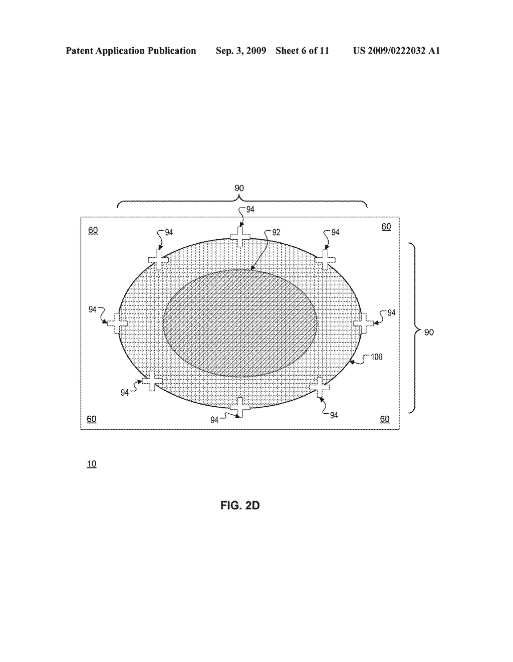 DEVICE AND METHOD OF WEIGHT CONTROL VIA INDIRECT ABDOMINAL CAVITY VOLUME REDUCTION - diagram, schematic, and image 07