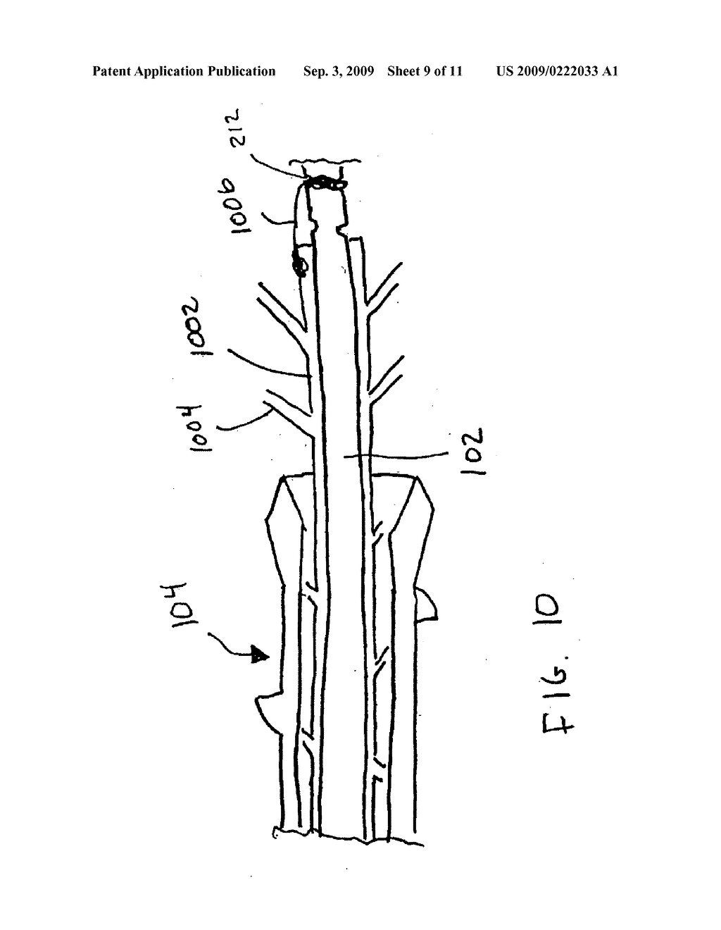 PERCUTANEOUS DEVICE AND METHOD FOR HARVESTING TUBULAR BODY MEMBERS - diagram, schematic, and image 10