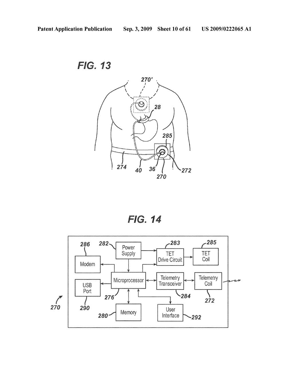 Physiological Parameter Analysis for an Implantable Restriction Device and a Data Logger - diagram, schematic, and image 11