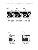 Physiological Parameter Analysis for an Implantable Restriction Device and a Data Logger diagram and image