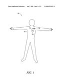 INTERCONNECTIONS OF IMPLANTABLE LEAD CONDUCTORS AND ELECTRODES AND REINFORCEMENT THEREFOR diagram and image