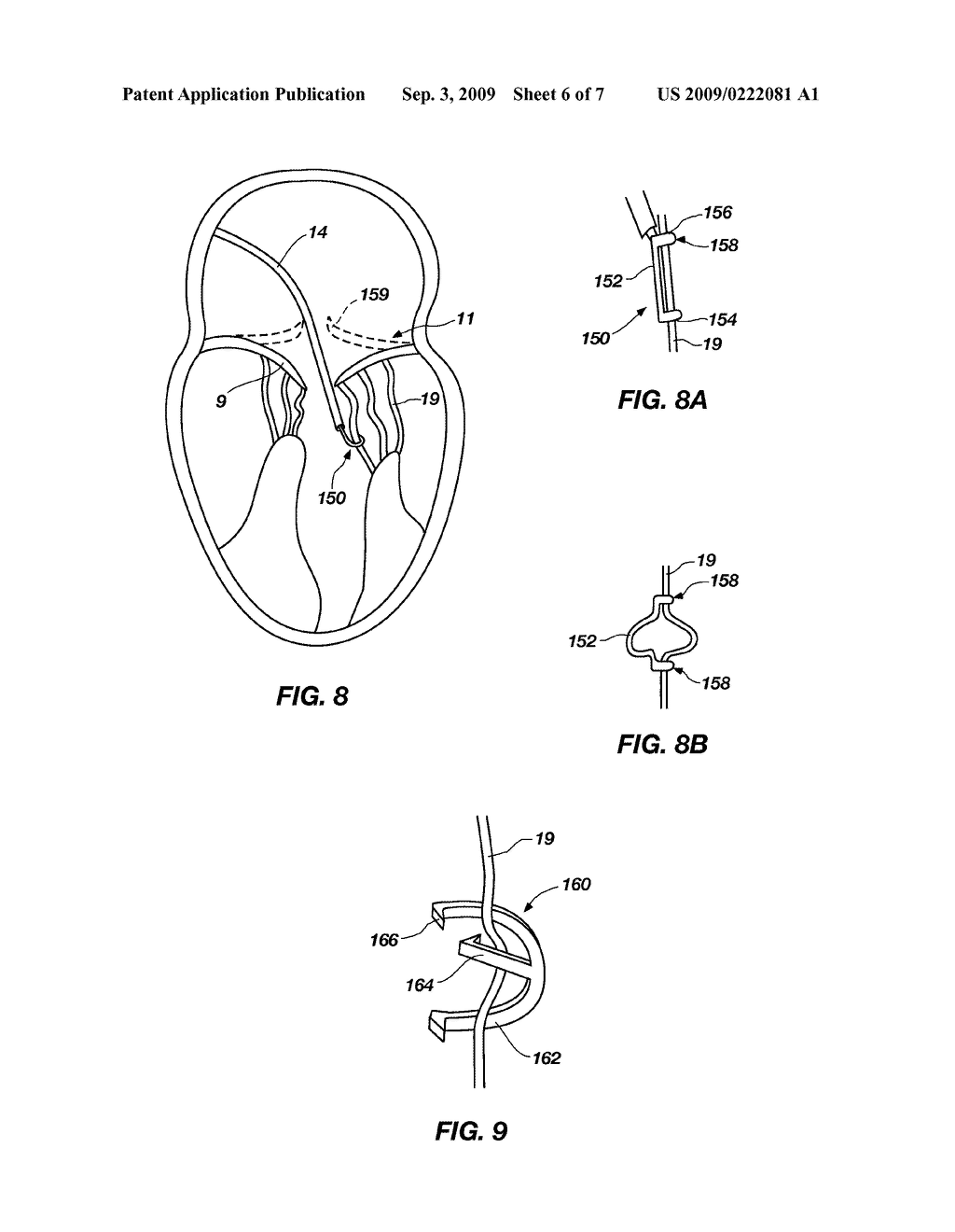 METHODS AND APPARATUS FOR REDUCING VALVE PROLAPSE - diagram, schematic, and image 07