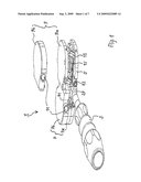 LIGAMENT-TENSIONING DEVICE diagram and image