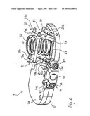 LIGAMENT-TENSIONING DEVICE diagram and image