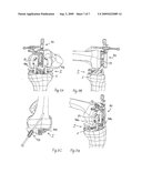 LIGAMENT-TENSIONING DEVICE diagram and image