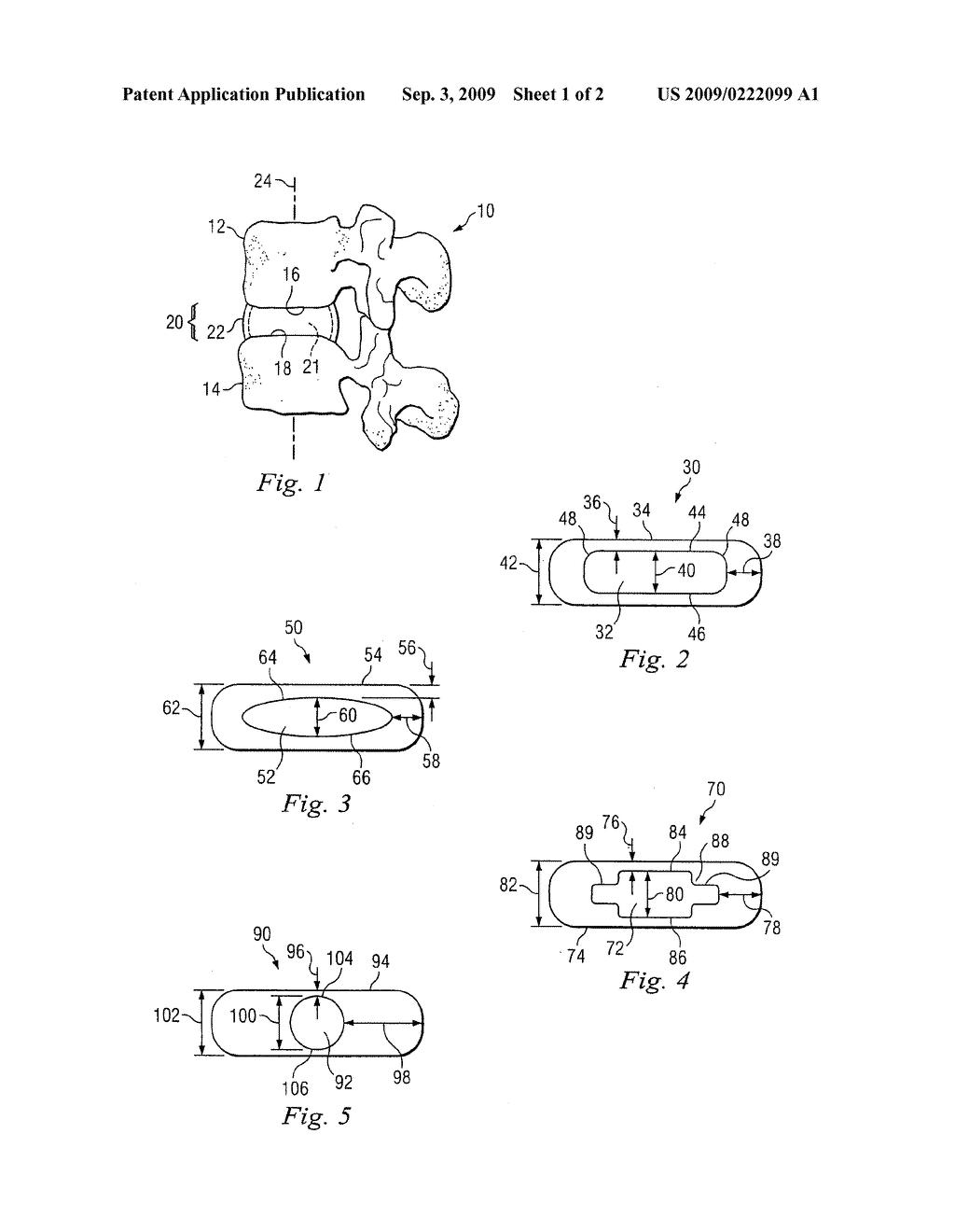 Self Centering Nucleus Implant - diagram, schematic, and image 02