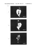 Marker for Selecting an Aphanomyces Cochlioides-Resistant Variety and Selection Method Therefor diagram and image