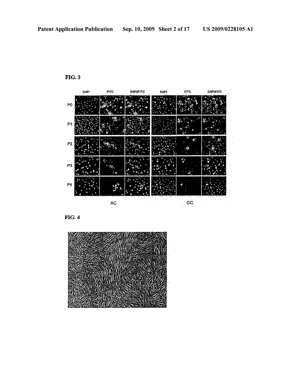 ARTIFICIAL CARTILAGE CONTAINING CHONDROCYTES OBTAINED FROM COSTAL CARTILAGE AND PREPARATION PROCESS THEREOF - diagram, schematic, and image 03