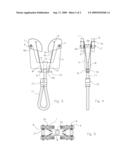 Camming device for anchoring to rock protrusions diagram and image