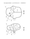 DUAL DEPTH AIRBAG WITH ACTIVE VENTING diagram and image