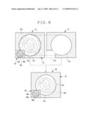 IMAGE PROCESSOR FOR ENDOSCOPE AND IMAGE PROCESSING METHOD FOR ENDOSCOPE diagram and image