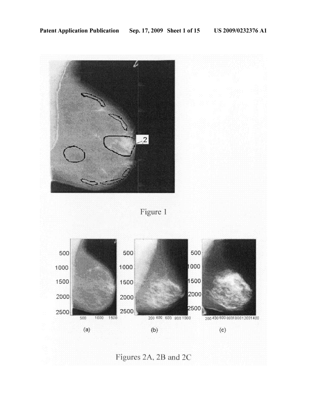 Breast tissue density measure - diagram, schematic, and image 02