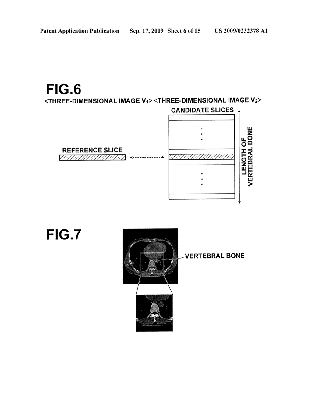 IMAGE ANALYSIS APPARATUS, IMAGE ANALYSIS METHOD, AND COMPUTER-READABLE RECORDING MEDIUM STORING IMAGE ANALYSIS PROGRAM - diagram, schematic, and image 07