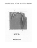 Novel method for chromatographic finger printing and standardization of single medicines and formulations diagram and image