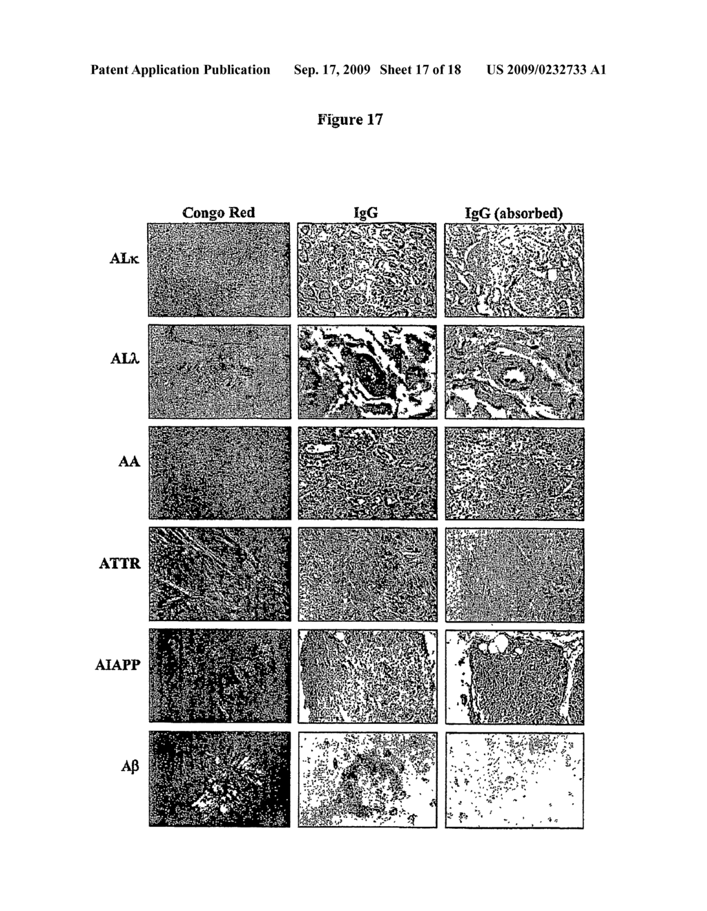 Diagnostic and Therapeutic Potential of Immune Globulin Intravenous (IGIV) Products - diagram, schematic, and image 18