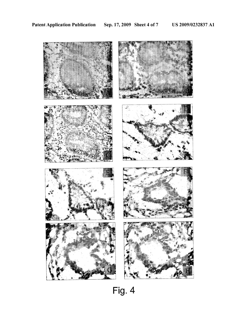 ANTI TUMORAL IMMUNOGENIC PEPTIDES AND VACCINE THEREOF - diagram, schematic, and image 05