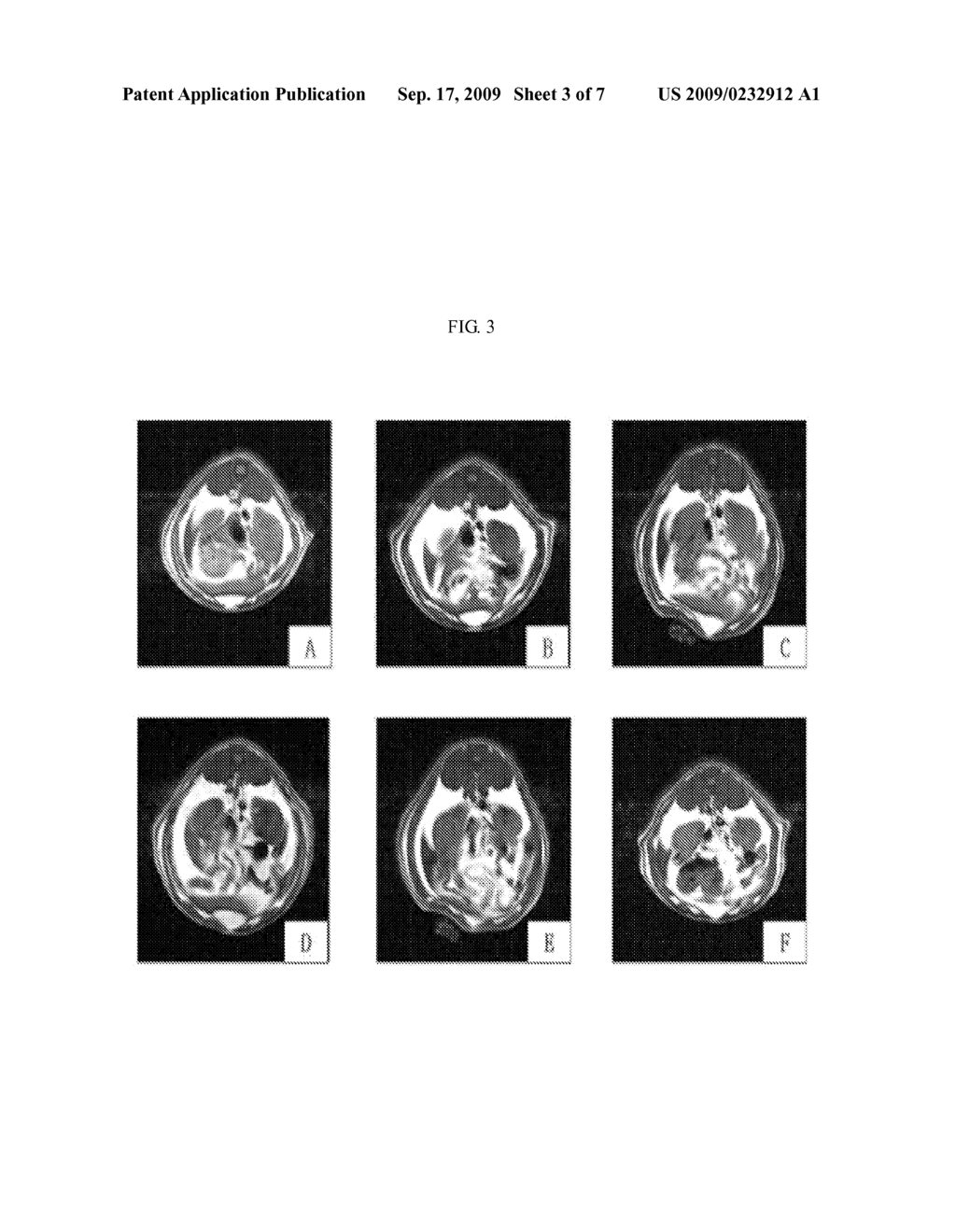 Method For Preparing Extract For The Prevention and Treatment Of Hyperlipidemia and Obesity From the Extract of Aster Spathulifolius Aerial Part and Composition Containing The Same - diagram, schematic, and image 04