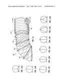 System and methods for forming barbed tape product with predetermined pattens of attachment points including patterns for concertina tape products configured for.... diagram and image