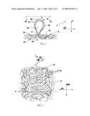 TUFTED FIBROUS WEB diagram and image